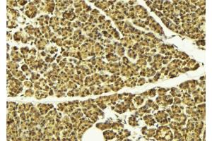 ABIN6274105 at 1/100 staining Mouse pancreas tissue by IHC-P. (AKAP8 抗体  (Internal Region))