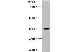 Western blot All lanes: DOK5 antibody at 2 μg/mL + Mouse kidney tissue Secondary Goat polyclonal to rabbit IgG at 1/15000 dilution Predicted band size: 36, 23 kDa Observed band size: 36 kDa (DOK5 抗体  (AA 1-198))