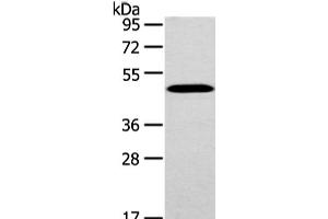 Western Blot analysis of Mouse brain tissue using WWOX Polyclonal Antibody at dilution of 1/200 (WWOX 抗体)