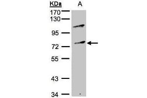 WB Image Sample(30 ug whole cell lysate) A:Raji , 10% SDS PAGE antibody diluted at 1:500 (MZF1 抗体)