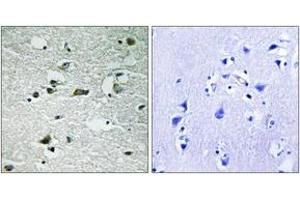 Immunohistochemistry analysis of paraffin-embedded human brain, using CK-1 gamma1/2/3 (Phospho-Tyr263) Antibody. (CK-1 gamma1/2/3 (AA 229-278), (pTyr263) 抗体)