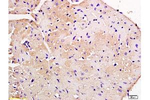 Formalin-fixed and paraffin embedded mouse heart tissue labeled with Anti-Nebulette Polyclonal Antibody, Unconjugated (ABIN1385611) at 1:200 followed by conjugation to the secondary antibody and DAB staining (Nebulette 抗体  (AA 360-403))