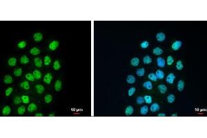 ICC/IF Image p63 antibody [N2C1], Internal detects p63 protein at nucleus by immunofluorescent analysis. (p63 抗体)