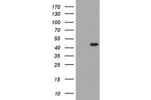 Western Blotting (WB) image for anti-Potassium Voltage-Gated Channel, Shaker-Related Subfamily, beta Member 1 (KCNAB1) antibody (ABIN1499002) (KCNAB1 抗体)