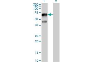 Western Blot analysis of TFCP2L1 expression in transfected 293T cell line by TFCP2L1 MaxPab polyclonal antibody. (TFCP2L1 抗体  (AA 1-479))