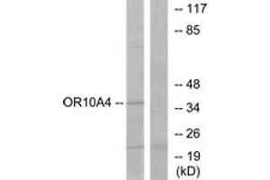 Western blot analysis of extracts from COLO cells, using OR10A4 Antibody. (OR10A4 抗体  (AA 261-310))