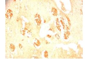Rat brain tissue was stained by Rabbit Anti-Metasin (1-25) / KISS-1 (68-92) (Human) Serum (KISS1 抗体  (AA 1-25, AA 68-92))