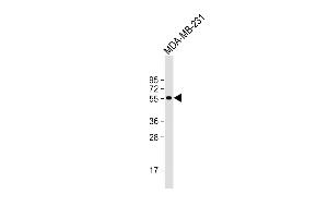 Anti-D Antibody (N-term) at 1:1000 dilution + MDA-MB-231 whole cell lysate Lysates/proteins at 20 μg per lane. (DMP1 抗体  (N-Term))