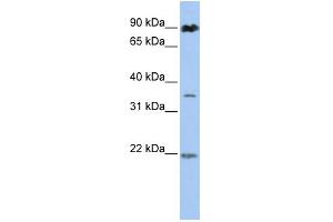 WB Suggested Anti-C13orf7  Antibody Titration: 0. (RNF219 抗体  (N-Term))