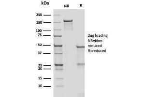 SDS-PAGE Analysis Purified CD209 Mouse Monoclonal Antibody (rC209/1781). (Recombinant DC-SIGN/CD209 抗体)