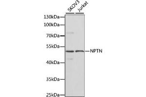 Western blot analysis of extracts of various cell lines, using NPTN antibody (ABIN6129584, ABIN6144789, ABIN6144790 and ABIN6223981) at 1:1000 dilution. (NPTN 抗体  (AA 29-200))