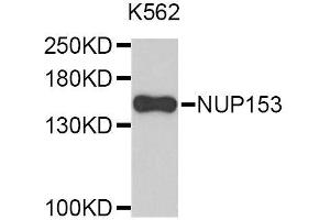 Western blot analysis of extracts of K-562 cells, using NUP153 antibody (ABIN5996414).