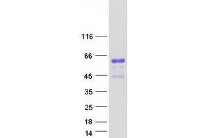 Western Blotting (WB) image for ATPase, Na+/K+ Transporting, beta 4 Polypeptide (ATP1B4) (Transcript Variant 2) protein (Myc-DYKDDDDK Tag) (ABIN2715041)