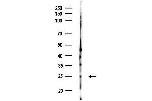 anti-Phosphoserine Phosphatase (PSPH) (Internal Region) antibody