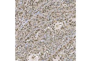 IHC analysis of SART1 using anti-SART1 antibody (ABIN7599884).