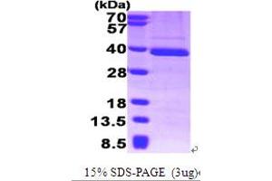 SDS-PAGE (SDS) image for General Transcription Factor IIB (GTF2B) (AA 1-316) protein (His tag) (ABIN666925)