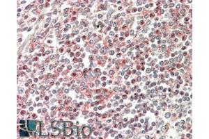 ABIN185254 (5µg/ml) staining of paraffin embedded Human Spleen. (CD2BP2 抗体  (N-Term))