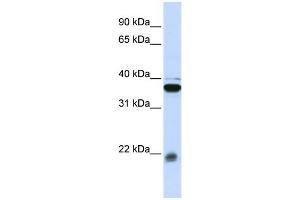 WB Suggested Anti-MYL9 Antibody Titration: 0. (MYL9 抗体  (Middle Region))