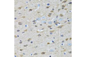 Immunohistochemistry of paraffin-embedded rat brain using GOLM1 antibody (ABIN5974385) at dilution of 1/100 (40x lens). (GOLM1 抗体)