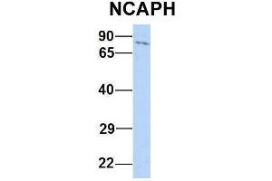 Host:  Rabbit  Target Name:  NCAPH  Sample Type:  Human Jurkat  Antibody Dilution:  1. (NCAPH 抗体  (N-Term))