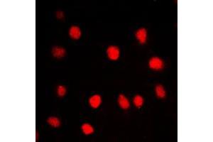 Immunofluorescent analysis of BRD3 staining in HepG2 cells. (BRD3 抗体  (C-Term))