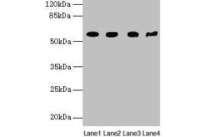Western blot All lanes: KRT79 antibody at 1 μg/mL Lane 1: Mouse lung tissue Lane 2: A549 whole cell lysate Lane 3: 293T whole cell lysate Lane 4: Mouse gonadal tissue Secondary Goat polyclonal to rabbit IgG at 1/10000 dilution Predicted band size: 58 kDa Observed band size: 58 kDa (Cytokeratin 79 抗体  (AA 1-300))