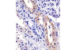 (ABIN6243380 and ABIN6577115) staining XI in human kidney sections by Immunohistochemistry (IHC-P - paraformaldehyde-fixed, paraffin-embedded sections). (XIAP 抗体)