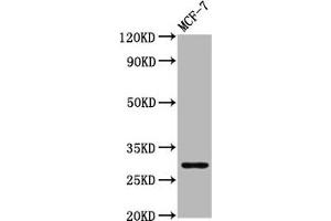Western Blot Positive WB detected in: MCF-7 whole cell lysate All lanes: MYOZ2 antibody at 4. (MYOZ2 抗体  (AA 90-180))