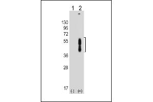 All lanes : Anti-PDCD1LG2 Antibody (N-term) at 1:8000 dilution Lane 1: Non-transfected 293T whole cell lysate Lane 2: Transfected PD-L2-transfected 293T whole cell lysate Lysates/proteins at 20 μg per lane. (PDCD1LG2 抗体  (N-Term))