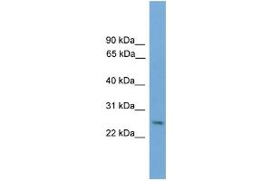 WB Suggested Anti-Dlx4 Antibody Titration: 0. (DLX4 抗体  (Middle Region))