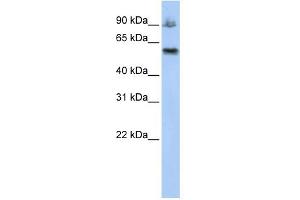 WB Suggested Anti-ASCC2 Antibody Titration:  0. (ASCC2 抗体  (Middle Region))