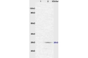 Lane 1: mouse intestine lysates Lane 2: mouse liver lysates probed with Anti CD161c/NK1. (NK-1.1/CD161c 抗体  (AA 101-200))