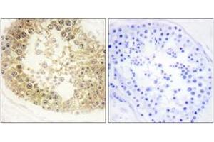 Immunohistochemistry analysis of paraffin-embedded human testis tissue, using ECRG4 Antibody. (C2orf40 抗体  (AA 41-90))
