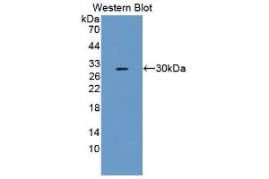 Western blot analysis of the recombinant protein. (Fibrosin 抗体  (AA 1-250))