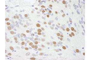 Immunohistochemistry (IHC) image for anti-RNA Binding Motif Protein 9 (RBM9) (AA 1-50) antibody (ABIN7448568) (RBM9 抗体  (AA 1-50))