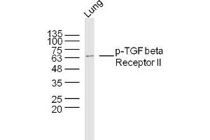Western Blotting (WB) image for anti-Transforming Growth Factor, beta Receptor II (70/80kDa) (TGFBR2) (pSer225) antibody (ABIN5675362)