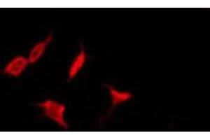ABIN6278702 staining HepG2 by IF/ICC. (Varicella Zoster Virus Thymidine kinase (VZV TK) 抗体)