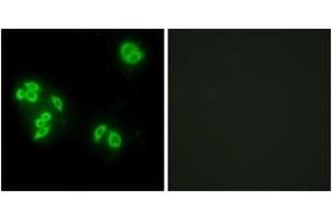 Immunofluorescence analysis of A549 cells, using TFIP8 Antibody. (Cytokeratin 5 抗体  (AA 31-80))