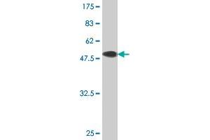 Western Blot detection against Immunogen (51. (TK1 抗体  (AA 1-234))