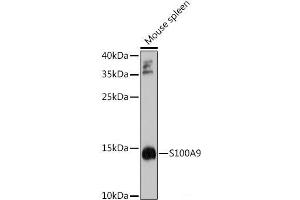 Western blot analysis of extracts of Mouse spleen using S100A9 Polyclonal Antibody at dilution of 1:1000. (S100A9 抗体)