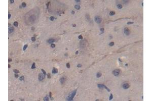Used in DAB staining on fromalin fixed paraffin- embedded kidney tissue (CD8B 抗体  (AA 21-208))