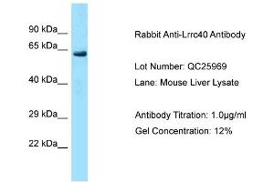 Host: Rabbit Target Name: Lrrc40 Sample Type: Mouse Liver Antibody Dilution: 1. (LRRC40 抗体  (C-Term))
