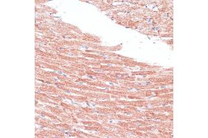 Immunohistochemistry of paraffin-embedded mouse heart using FZD4 antibody (ABIN6131550, ABIN6140841, ABIN6140842 and ABIN6224186) at dilution of 1:100 (40x lens). (FZD4 抗体  (AA 37-222))