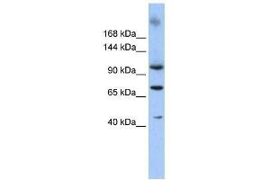 Western Blot showing TUT1 antibody used at a concentration of 1-2 ug/ml to detect its target protein. (TUT1 抗体  (N-Term))