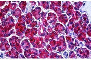 Human Pancreas: Formalin-Fixed, Paraffin-Embedded (FFPE) (PHGDH 抗体  (AA 1-534))