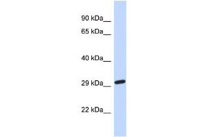 Host:  Rabbit  Target Name:  NAALAD2  Sample Type:  Fetal Brain lysates  Antibody Dilution:  1. (NAALAD2 抗体  (Middle Region))