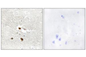 Immunohistochemistry analysis of paraffin-embedded human brain tissue using ZNF287 antibody. (ZNF287 抗体  (Internal Region))