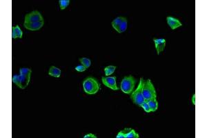 Immunofluorescent analysis of MCF-7 cells using ABIN7175490 at dilution of 1:100 and Alexa Fluor 488-congugated AffiniPure Goat Anti-Rabbit IgG(H+L) (SEC22A 抗体  (AA 10-187))