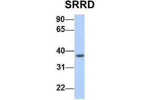Host:  Rabbit  Target Name:  SRRD  Sample Type:  Jurkat  Antibody Dilution:  1. (SRRD 抗体  (Middle Region))