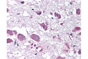 Anti-HCRT / Orexin antibody IHC of human brain, hypothalamus. (Orexin 抗体  (AA 2-14))